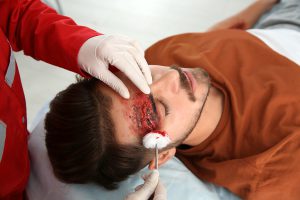 the-five-most-common-head-injuries-following-an-auto-accident